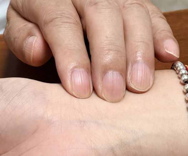 Fingertip pulse assessment / 指尖触脉辨证